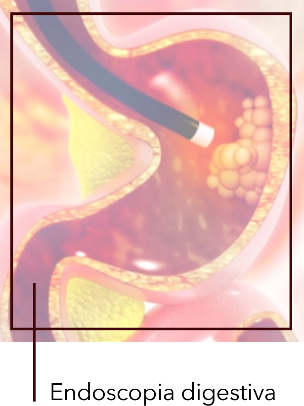 endoscopia digestiva